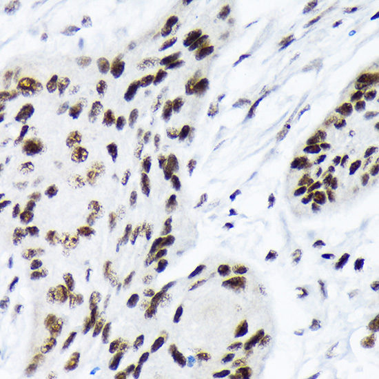 ARID1A Monoclonal Antibody [9D4J6]