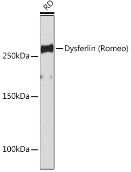 Dysferlin Monoclonal Antibody [3U1P9]