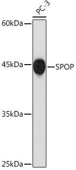 SPOP Monoclonal Antibody [2N8L8]