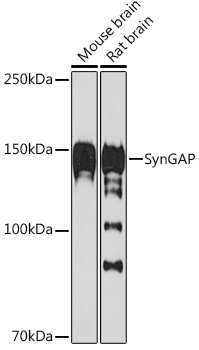 SynGAP Monoclonal Antibody [8M2S9]