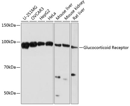 Glucocorticoid Receptor Monoclonal Antibody [2K3E8]