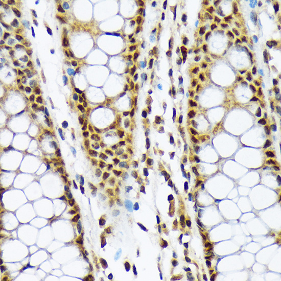 MAD2L1BP Monoclonal Antibody [7W8H1]