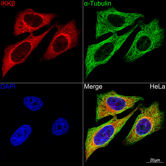 IKKB Monoclonal Antibody