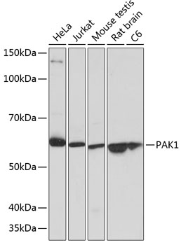 PAK1 Monoclonal Antibody [6R3M5]
