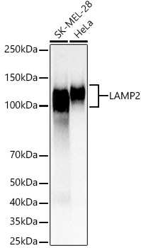 LAMP2 Polyclonal Antibody