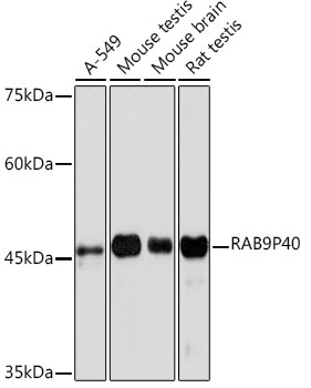 RAB9P40 Monoclonal Antibody [10E2A4]