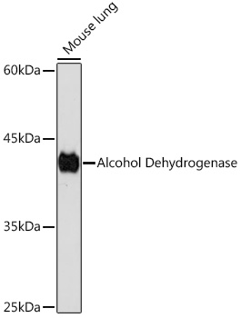 Alcohol Dehydrogenase Monoclonal Antibody [1X3C0]