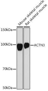 ACTN3 Monoclonal Antibody [4H7E6]