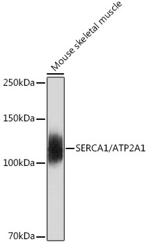 SERCA1/ATP2A1 Monoclonal Antibody [2T8S3]