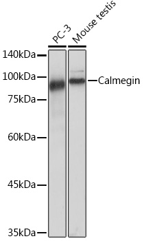 Calmegin Monoclonal Antibody [8R8M1]