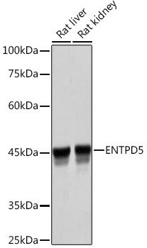 ENTPD5 Monoclonal Antibody [9R1B3]