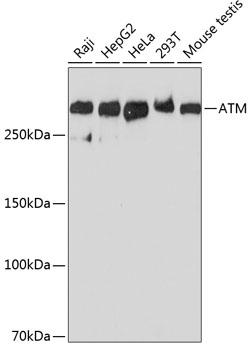 ATM Monoclonal Antibody [6P6C6]
