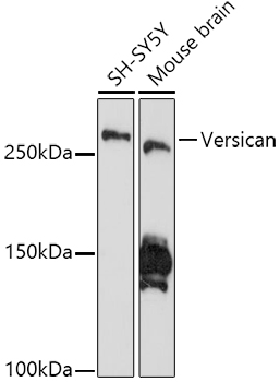 Versican Monoclonal Antibody [6D8K9]