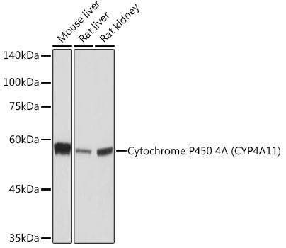 Cytochrome P450 4A (CYP4A11) Monoclonal Antibody [10D10W7]