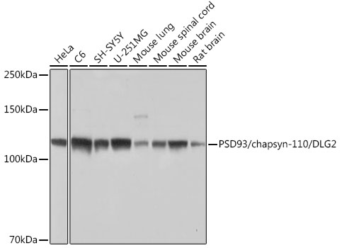 PSD93/chapsyn-110/DLG2 Monoclonal Antibody [0G4O6]