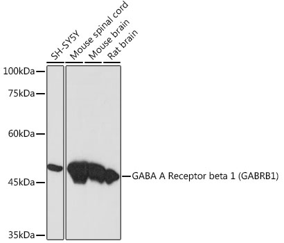 GABA A Receptor beta 1 (GABRB1) Monoclonal Antibody [1Q3A9]