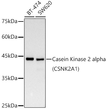 Casein Kinase 2 alpha (CSNK2A1) Monoclonal Antibody [2P3M7]