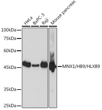 MNX1/HB9/HLXB9 Monoclonal Antibody [9P1B7]