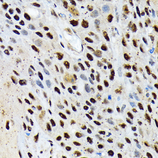 ENT2/SLC29A2 Monoclonal Antibody [7B2J3]