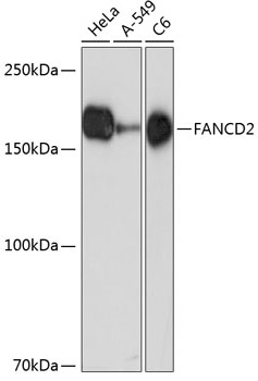 FANCD2 Monoclonal Antibody [7U2D6]