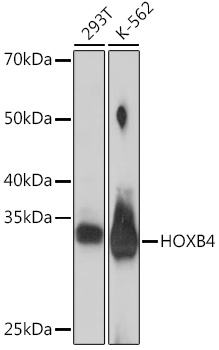 HOXB4 Monoclonal Antibody [6M4G5]