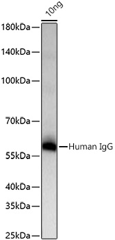 Human IgG Monoclonal Antibody [1U6H0]