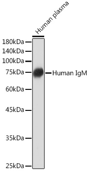Human IgM Monoclonal Antibody [6F7T2]