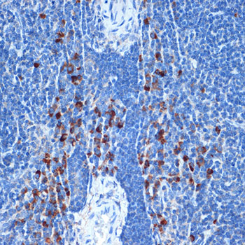 NAIP Monoclonal Antibody [6B9M10]
