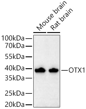 OTX1 Monoclonal Antibody [6H7J9]
