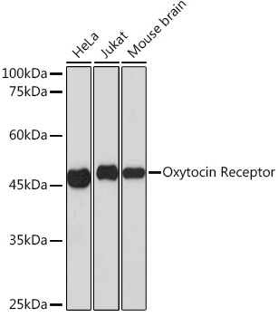 Oxytocin Receptor Monoclonal Antibody [7X8B8]