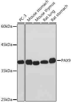 PAX9 Monoclonal Antibody [3C2U5]