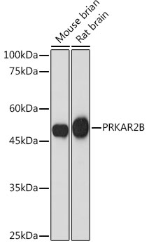 PRKAR2B Monoclonal Antibody [2U2P1]