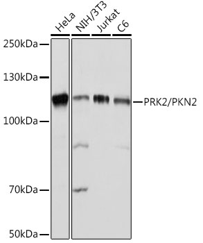 PRK2/PKN2 Monoclonal Antibody [5O2G6]