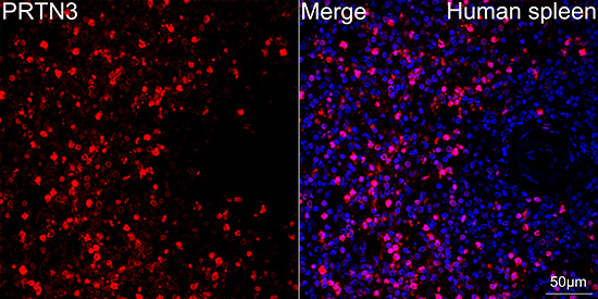 Proteinase 3/PR3 Monoclonal Antibody [3I3M1]