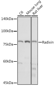 Radixin Monoclonal Antibody [4U6W9]