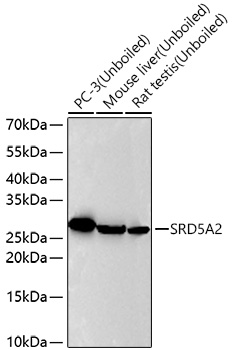 SRD5A2 Monoclonal Antibody [8A4H5]