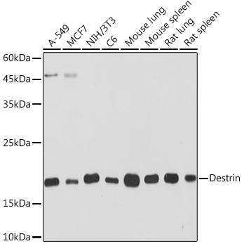 Destrin Monoclonal Antibody [4F9Q1]