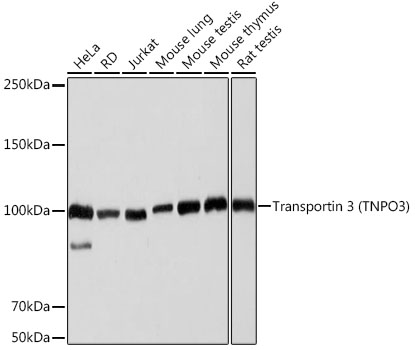 Transportin 3 (TNPO3) Monoclonal Antibody [0U3Q1]