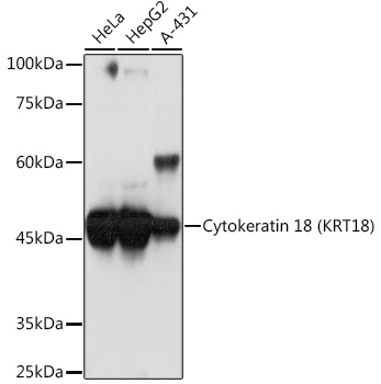 Cytokeratin 18 (KRT18) Monoclonal Antibody