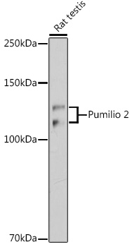 Pumilio 2 Monoclonal Antibody [7M1B1]