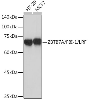 ZBTB7A/FBI-1/LRF Monoclonal Antibody [3T2J1]