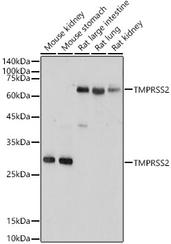 TMPRSS2 Polyclonal Antibody