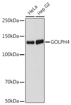 GOLPH4 Monoclonal Antibody [10J7E6]