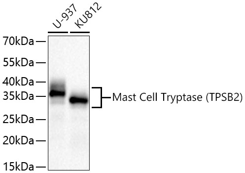 Mast Cell Tryptase (TPSB2) Monoclonal Antibody [6U1C5]