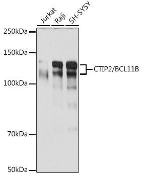 CTIP2/BCL11B Monoclonal Antibody [9C1B6]