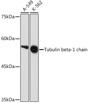 Tubulin beta-1 chain Monoclonal Antibody [2Z6P1]