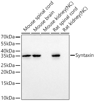 Syntaxin Monoclonal Antibody [7D9V8]
