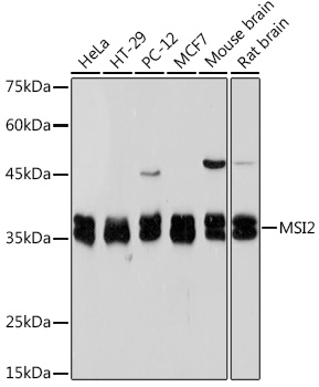 Musashi-2 (MSI2) Monoclonal Antibody [7L4E9]