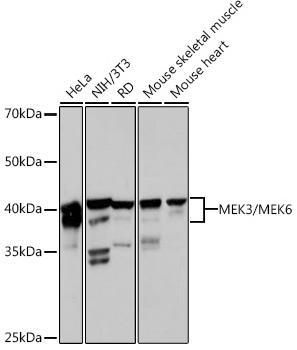 MEK3/MEK6 Monoclonal Antibody [8R1J5]