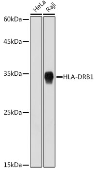 HLA-DRB1 Monoclonal Antibody [6Z1F10]